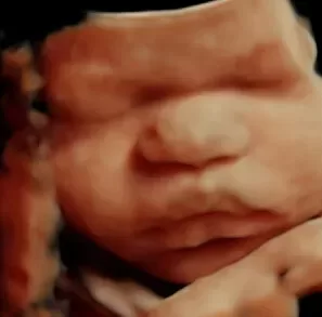 Miracle In Motion Women Ultrasound Center 3D, 4D, 5D / HD Live, and 8K Hyper-realistic